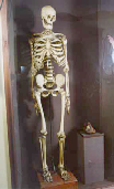 Скелет Буржуа